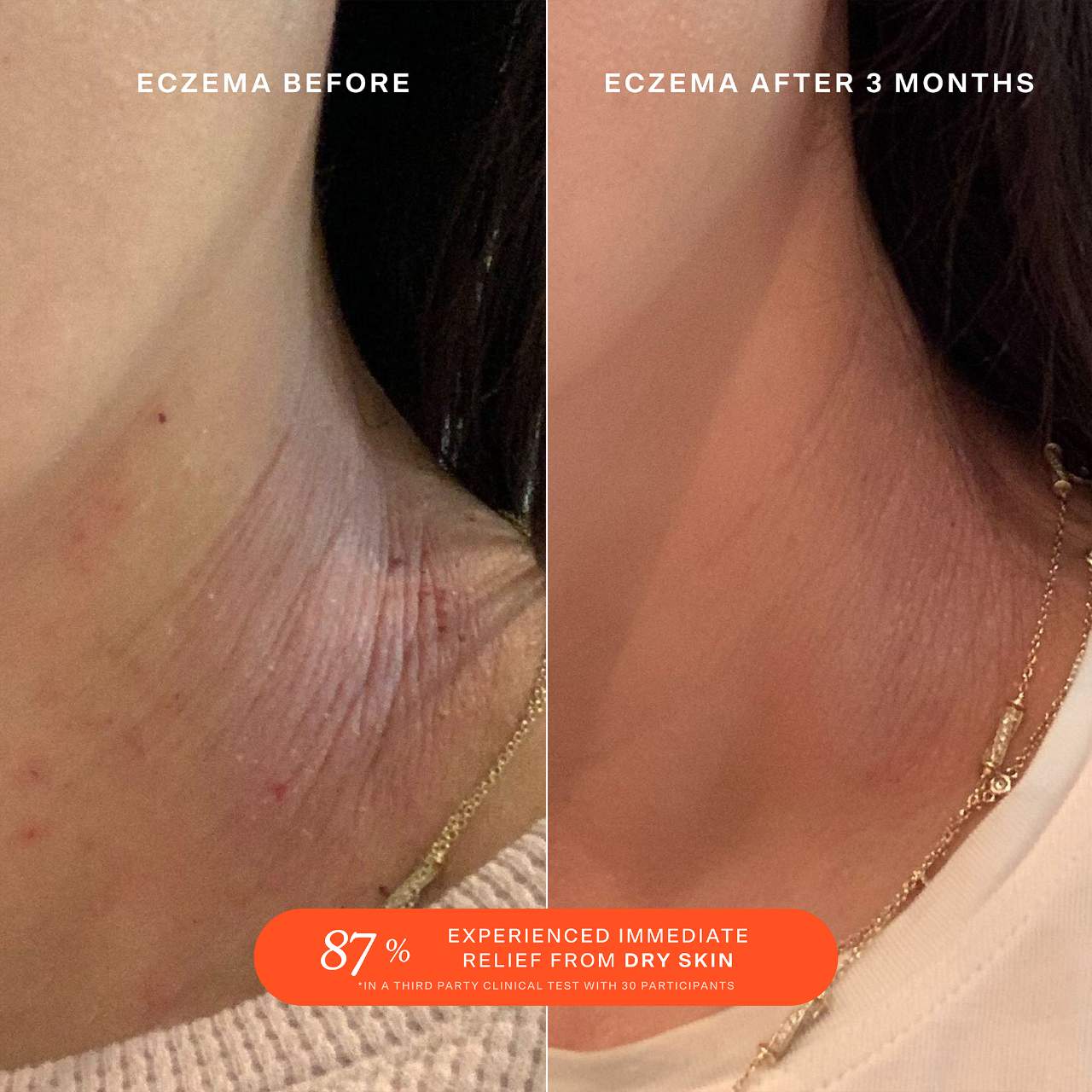 SOS Daily Rescue Facial Spray with Hypochlorous Acid