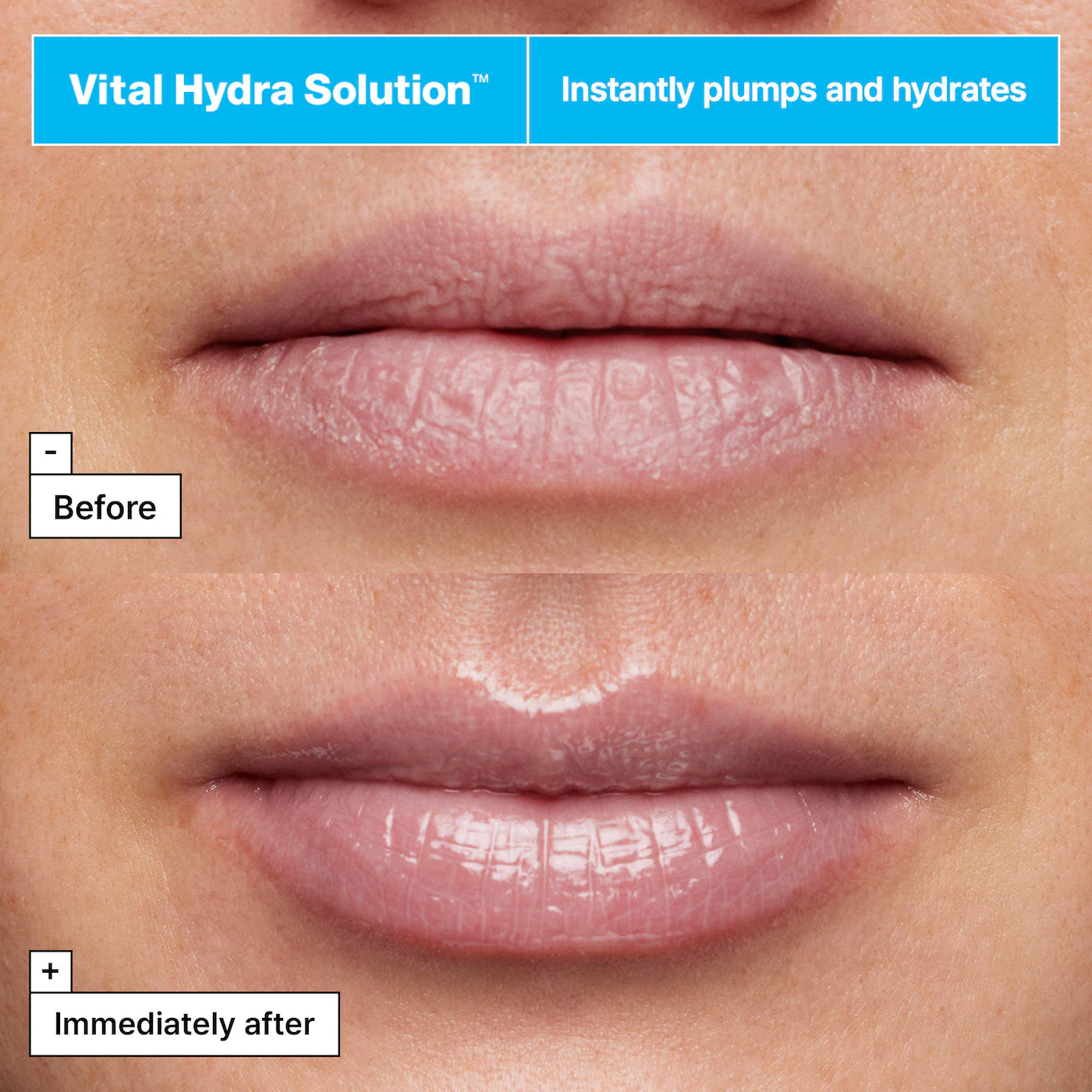 Lip Value Set - Sephora Favorites